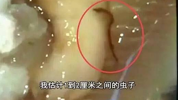 一只生蚝引起的冤案，触动了餐饮人的“麻木神经”